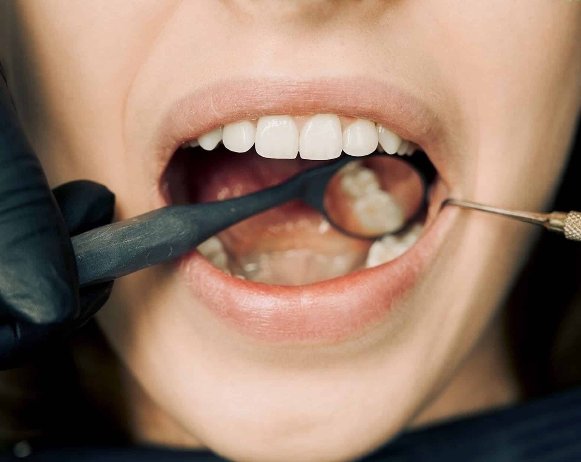 Dents En Forme De Sourire Avec Loupe Bilan Dentaire Concept D'examen De La  Bouche Des Gencives Visite De Routine Chez Le Dentiste Et Vérification De  La Maladie Parodontale De La Plaque De Cavité